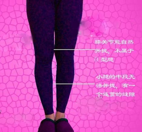 健身训练 减肥瘦身    第一种情况,符合上面的标准腿型,其实腿是很直